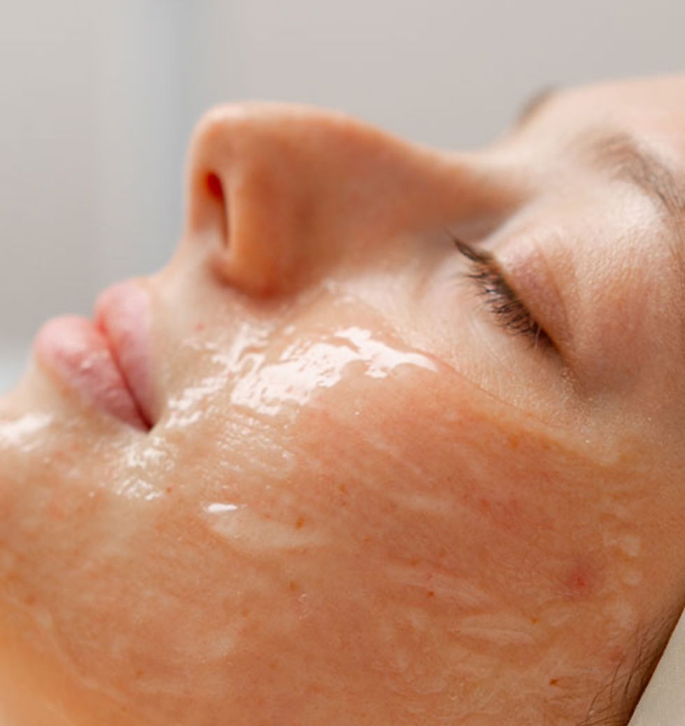 Bio microneedling.PNG