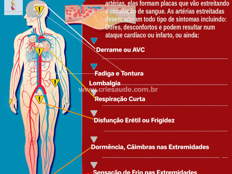 Aterosclerose e Tratamentos Naturais