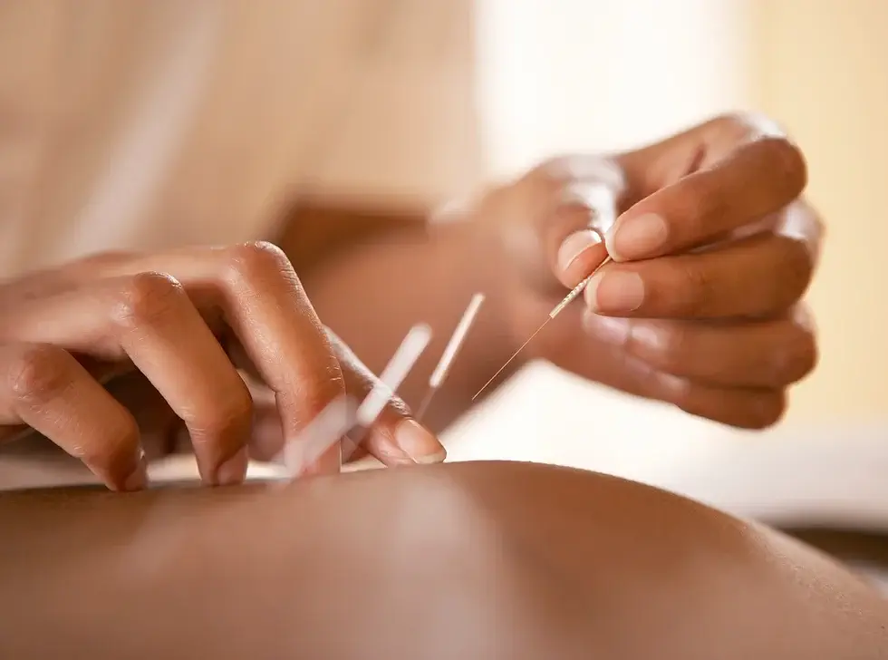 Laetitia thérapeute spécialisée en acupuncture