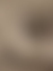 Reacting to a girl dying of anorexia.