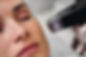 pdgf-microneedling-device-on-cheek..jpeg