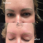 Eyebrow removal process