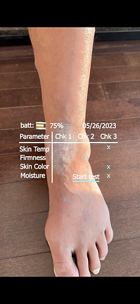 Splint Skin Check SAM | Skin Check