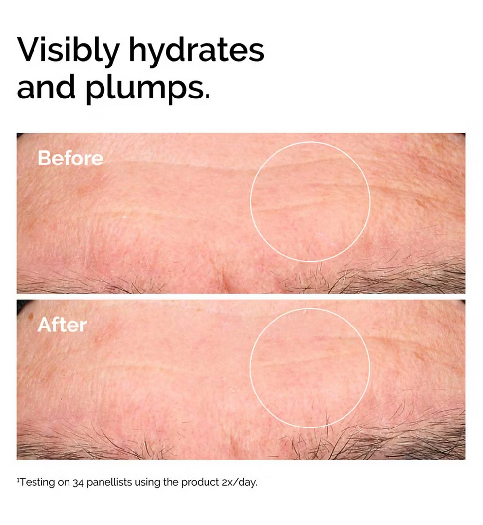 Thumbnail: The Ordinary Hyaluronic Acid 2% + B5 Hydrating Serum - 30ml