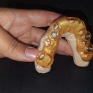 Guia para Cirurgia Guiada