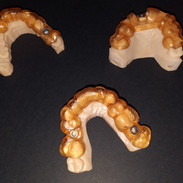 Guia para Cirurgia Guiada