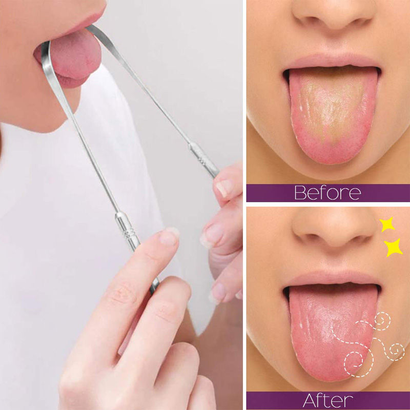Thumbnail: 1 Tongue Scraper Cleaner Adult Surgical Grade Eliminate Bad Breath Stainless Ste