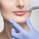 Upper-Lip-Laser-Hair-Removal.png
