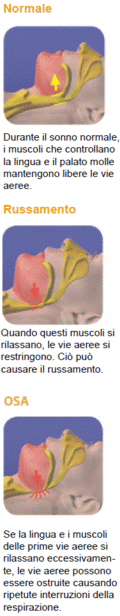 apnea.gif