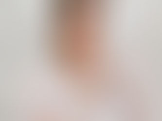 Queda de cabelo pós COVID-19 