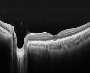 Background OCT 3.png