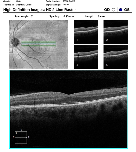 Neuro-Ophthalmology 8-4.png