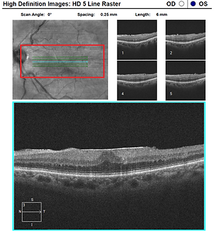 Background OCT 7.png