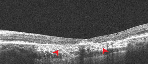 Retina 27-6.png