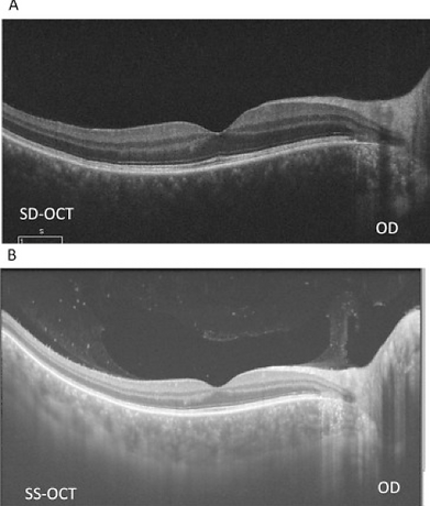 Background OCT 2.png