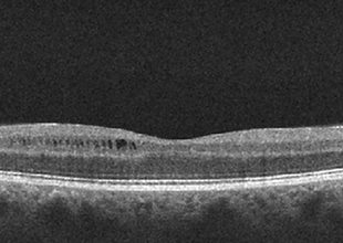 Neuro-Ophthalmology 15-2.png