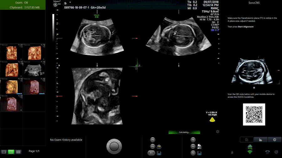 Whole examination AI estimation of fetal biometrics from 20