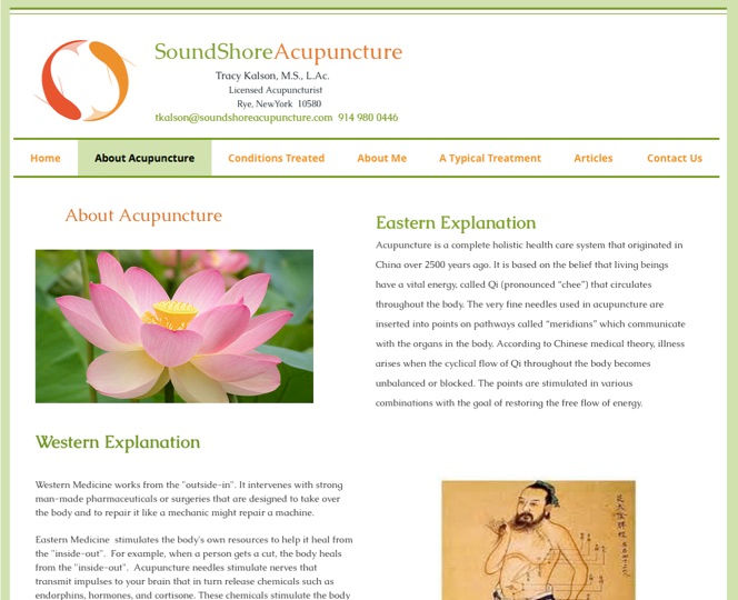 about acupuncture