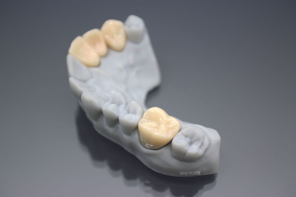 Thumbnail: FREEPRINT Temp 385, 1kg