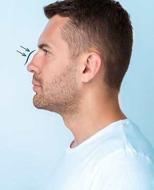 man-getting-ready-nose-job-surgery_edited.jpg