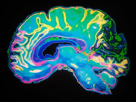 The Dopamine Dynamics of Eating Disorders