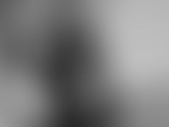 Udar mózgu a występowanie depresji poudarowej