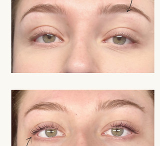 Green and Beige Minimalist Skincare Befo