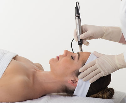 dermapen cozens beauty