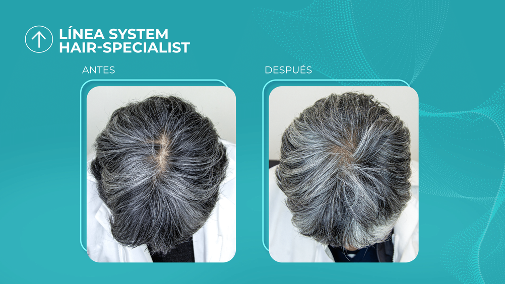 Testimonios: MEJORA EN CAIDA DE CABELLO