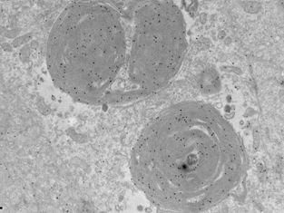 A New Organelle Discovered: Harvard Scientists Discover Phosphate Storing PXo Bodies
