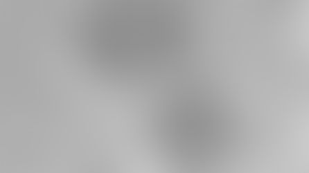 A New Organelle Discovered: Harvard Scientists Discover Phosphate Storing PXo Bodies