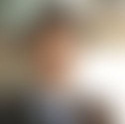 The Role of Surplus Recovery Professionals