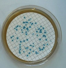 Enterococci_edited.jpg