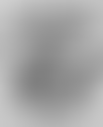 A Changed Brain Is Still a Whole Person