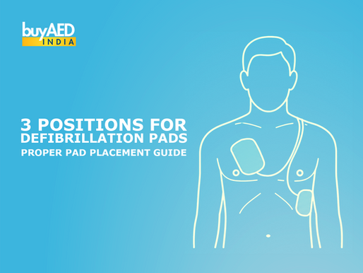 3 Positions for Defibrillation Pads