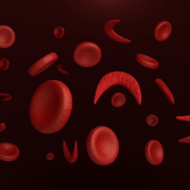 sicklecells