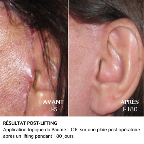 Cebelia L.C.E. Balm (Capacity: 15ml) | OHRAJIN