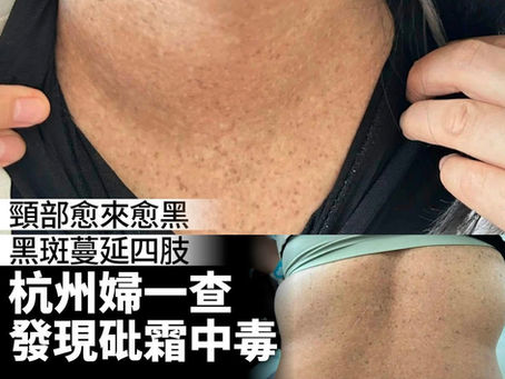 安全用藥
