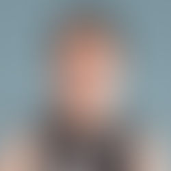 Facial Pigmentation Treatment, Meera Sharma (32, Graphic Designer)Background.