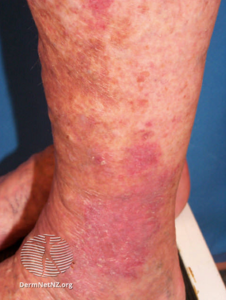 Dermatology - integral in hospital care