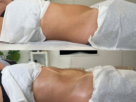 menopause bloating reduced