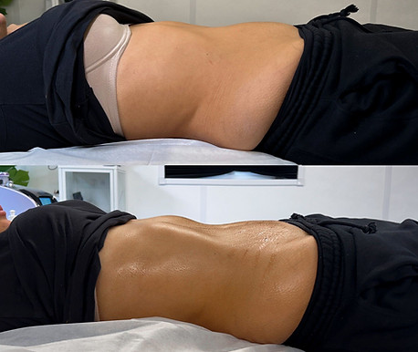 lymphatic drainage massage result in Northampton