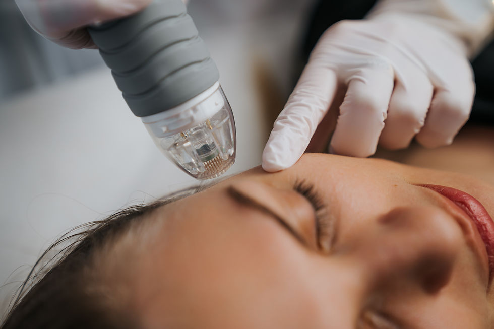 RF Microneedling