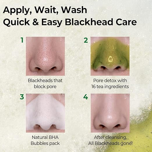 Thumbnail: Some By Mi | Bye Bye Blackhead 30 Days Miracle Green Tea Tox Bubble Cleanser