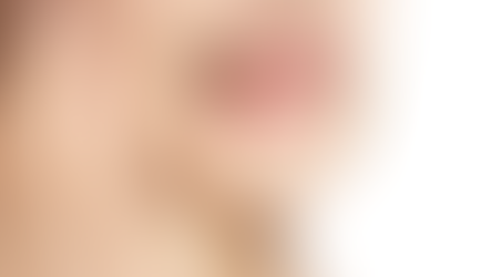 Sensibilidade Dentária: Causas e o Que Fazer