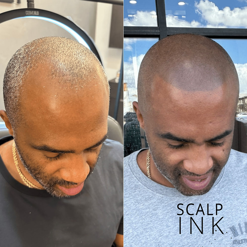 How Does Scalp Micropigmentation Work? A Comprehensive Guide to the Process