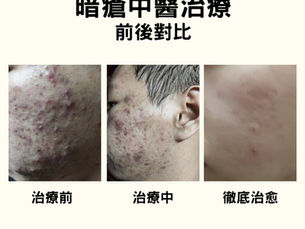 中藥更令人健康漂亮