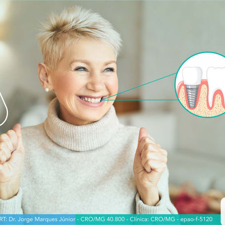 Como garantir um implante dentário de sucesso