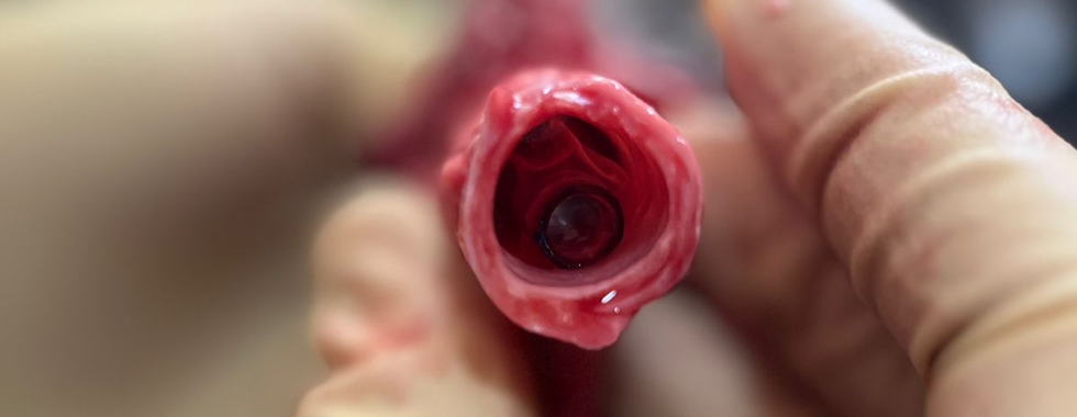 ROCKET Training Definitive Airway Management in Teams