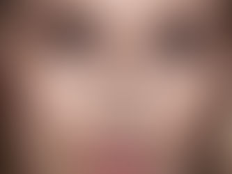 Preparing for Anti-Wrinkle Treatment in Galway | Dr. Mark Hamilton